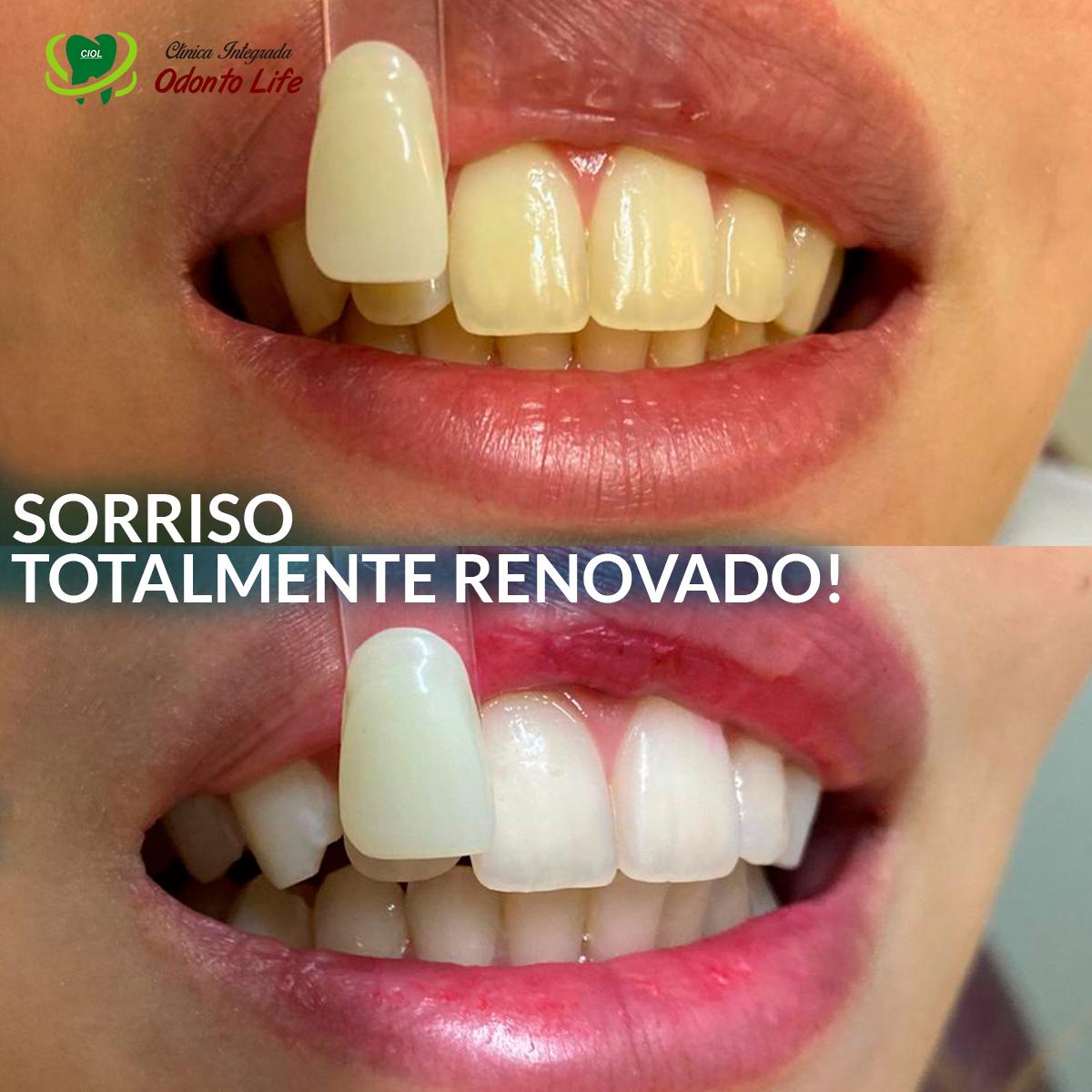 Foto 4 da galeria